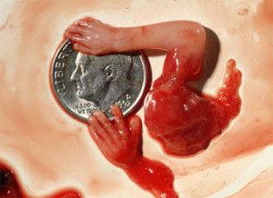 abortion 08